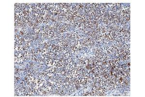 IHC analysis of ARF6 using anti-ARF6 antibody (ABIN4886473). (ARF6 抗体  (AA 2-175))