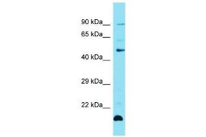 Host:  Rabbit  Target Name:  Zfp27  Sample Type:  Mouse Thymus lysates  Antibody Dilution:  1.