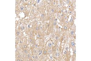 Immunohistochemistry of paraffin-embedded human liver using IQG Rabbit mAb (ABIN7268021) at dilution of 1:25 (40x lens). (IQGAP2 抗体)