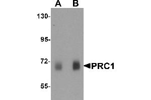 Western blot analysis of PRC1 in human skeletal muscle tissue lysate with Prc1 antibody at (A) 0. (PRC1 抗体  (Middle Region))