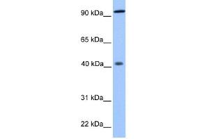 WB Suggested Anti-PYGO1 Antibody Titration:  0. (PYGO1 抗体  (N-Term))