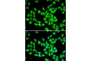 Immunofluorescence analysis of HeLa cells using PCMT1 antibody. (PCMT1 抗体)
