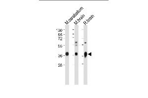 Western Blotting (WB) image for anti-Guanine Nucleotide Binding Protein (G Protein), alpha Activating Activity Polypeptide O (GNAO1) (AA 291-320), (C-Term) antibody (ABIN653078)