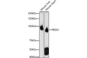 Western blot analysis of extracts of various cell lines, using PROX1 antibody (ABIN6132519, ABIN6146252, ABIN6146253 and ABIN6216882) at 1:1000 dilution. (PROX1 抗体  (AA 1-300))