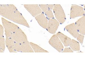 Detection of MYH1 in Mouse Skeletal muscle Tissue using Polyclonal Antibody to Myosin Heavy Chain 1 (MYH1) (MYH1 抗体  (AA 1585-1642))
