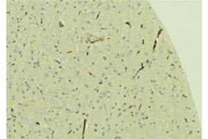 ABIN6279652 at 1/100 staining Mouse brain tissue by IHC-P. (PREX1 抗体  (Internal Region))