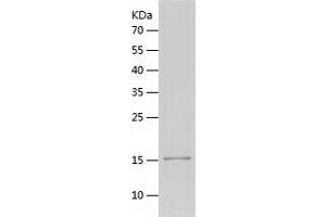 USP5 Protein (AA 163-291) (His tag)
