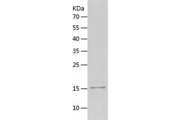 USP5 Protein (AA 163-291) (His tag)