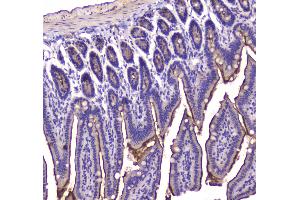 IHC analysis of Cannabinoid Receptor I using anti-Cannabinoid Receptor I antibody . (CNR1 抗体  (AA 1-75))