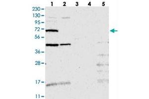 Western blot analysis of Lane 1: RT-4, Lane 2: U-251 MG, Lane 3: Human Plasma, Lane 4: Liver, Lane 5: Tonsil with TMEM87B polyclonal antibody  at 1:250-1:500 dilution. (TMEM87B 抗体)