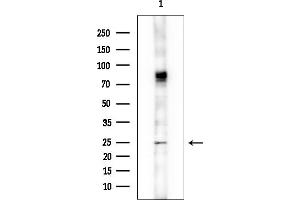 Western blot analysis of lysates from COLO205 cells, using MLF1 Antibody at 1/1000 dilution.