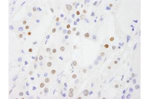 anti-DEAD (Asp-Glu-Ala-Asp) Box Polypeptide 54 (DDX54) (AA 625-675) antibody