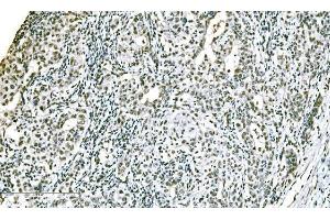 IHC analysis of ADAR1/ADAR using anti-ADAR1/ADAR antibody (ABIN7598956). (ADAR 抗体  (AA 1-1152))