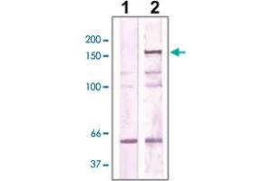 The cell lysate derived from NIH/3T3 was immunoprecipitated by ROCK2 polyclonal antibody , then immunoprobed by the same antibody at 1 : 500 (lane 2). (ROCK2 抗体  (AA 250-350))