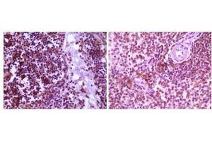 Immunohistochemical analysis of paraffin-embedded human thymoma tissue (left) and spleen tissue (right), showing cytoplasmic localization using MAP2K4 antibody with DAB staining. (MAP2K4 抗体)