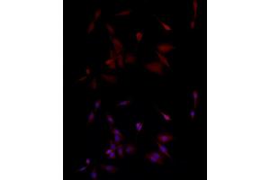Immunofluorescence analysis of PC-12 cells using PGP9. (UCHL1 抗体  (AA 1-220))