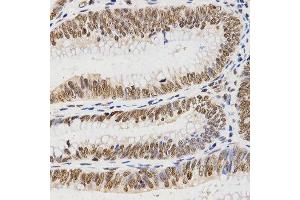 Immunohistochemistry (IHC) image for anti-Histone 3 (H3) (C-Term) antibody (ABIN3023243)