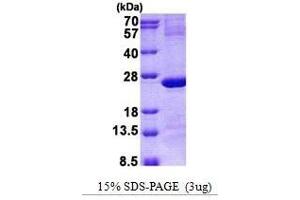 Figure annotation denotes ug of protein loaded and % gel used. (IMP3 蛋白)