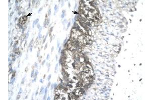 ACAT2 antibody was used for immunohistochemistry at a concentration of 4-8 ug/ml to stain Ganglionic cells (arrows) in Human Stomach. (ACAT2 抗体)
