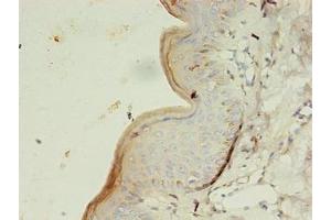 Immunohistochemistry of paraffin-embedded human skin tissue using ABIN7154151 at dilution of 1:100 (GK3P 抗体  (AA 1-220))