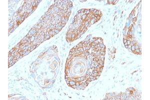 Formalin-fixed, paraffin-embedded human Pancreas stained with Spectrin Beta 3 Rabbit Monoclonal Antibody (SPTBN2/2979R). (Recombinant Spectrin, Beta, Non-erythrocytic 2 (SPTBN2) (AA 356-475) 抗体)