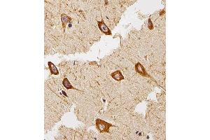 Immunohistochemical analysis of paraffin-embedded H. (EEF1B2 抗体  (AA 54-86))