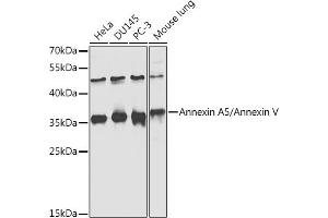Western blot analysis of extracts of various cell lines, using Annexin /Annexin V antibody  at 1:1000 dilution. (Annexin V 抗体  (AA 1-320))