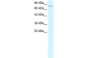 WB Suggested Anti-ENG Antibody Titration:  2. (Endoglin 抗体  (N-Term))