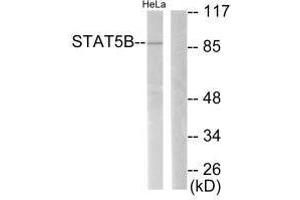 Western blot analysis of extracts from RAW264. (STAT5B 抗体  (Ser731))