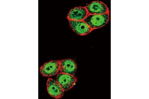 Confocal immunofluorescent analysis of Phospho-SD2- Antibody (ABIN650816 and ABIN2839794) with Hela cell followed by Alexa Fluor 488-conjugated goat anti-rabbit lgG (green). (SMAD2 抗体  (pThr220))