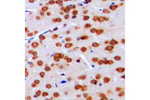 Immunohistochemical analysis of TCFL4 staining in human brain formalin fixed paraffin embedded tissue section. (MLX 抗体  (Center))