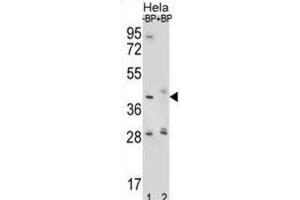 Western Blotting (WB) image for anti-Hyaluronidase-2 (HYAL2) antibody (ABIN2996780) (HYAL2 抗体)