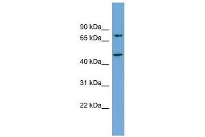 AGGF1 antibody used at 1 ug/ml to detect target protein. (AGGF1 抗体  (Middle Region))
