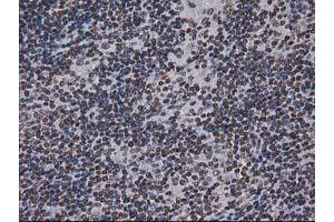 Image no. 4 for anti-CTD (Carboxy-terminal Domain, RNA Polymerase II, Polypeptide A) Small Phosphatase 1 (CTDSP1) antibody (ABIN1497679) (CTDSP1 抗体)