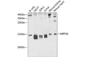 Western blot analysis of extracts of various cell lines, using MRPS6 antibody (ABIN6133092, ABIN6144048, ABIN6144049 and ABIN6225227) at 1:1000 dilution. (MRPS6 抗体  (AA 1-125))
