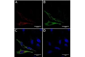 Immunofluorescence staining of fixed HeLa cells expressing mCherry tagged GCN4 with anti-GCN4 antibody C11L34. (Recombinant GCN4 抗体)