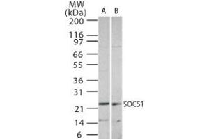 Image no. 1 for anti-Suppressor of Cytokine Signaling 1 (SOCS1) (AA 54-68) antibody (ABIN233230) (SOCS1 抗体  (AA 54-68))