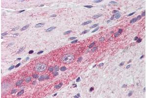 Human Small Intestine, Myenteric Plexus: Formalin-Fixed, Paraffin-Embedded (FFPE) (RHOA 抗体  (AA 1-194))