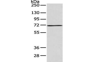 Gel: 8 % SDS-PAGE, Lysate: 40 μg, Lane: 293T cell, Primary antibody: ABIN7128186(ACSM5 Antibody) at dilution 1/200 dilution, Secondary antibody: Goat anti rabbit IgG at 1/8000 dilution, Exposure time: 30 seconds (ACSM5 抗体)