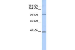 WB Suggested Anti-REST Antibody Titration:  0. (REST 抗体  (Middle Region))