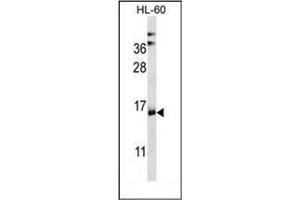 Western Blotting (WB) image for anti-NADH Dehydrogenase (Ubiquinone) 1 alpha Subcomplex, Assembly Factor 4 (NDUFAF4) (AA 32-61), (N-Term) antibody (ABIN953631)