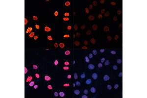 Immunofluorescence analysis of HeLa cells using Acetyl-Histone H3-K18 antibody (ABIN7267668) at dilution of 1:100. (Histone 3 抗体  (H3K18))