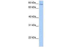 SLITRK1 antibody used at 1 ug/ml to detect target protein. (SLITRK1 抗体  (N-Term))