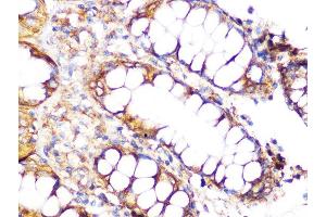 Immunohistochemistry (IHC) image for anti-Clathrin Heavy Chain (CLTC) antibody (ABIN7266404)