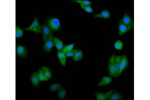 Immunofluorescence staining of HepG2 cells with ABIN7146463 at 1:66, counter-stained with DAPI. (Calicin 抗体  (AA 240-351))