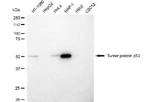 Western blotting analysis using tumor protein p53 antibody (ABIN7800685). (p53 抗体)