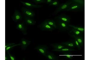 Immunofluorescence of monoclonal antibody to MBD5 on HeLa cell. (MBD5 抗体  (AA 1-229))