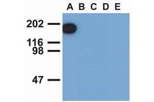 Western Blotting (WB) image for anti-Epidermal Growth Factor Receptor (EGFR) (pTyr1197) antibody (ABIN400879) (EGFR 抗体  (pTyr1197))