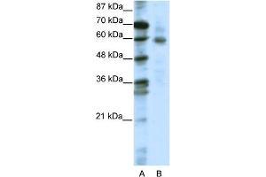 WB Suggested Anti-FOXO1A Antibody Titration:  2.