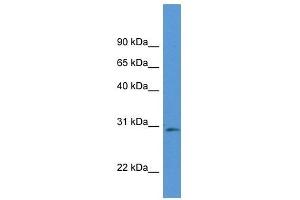 Western Blot showing Rpia antibody used at a concentration of 1. (Ribose 5-Phosphate Isomerase A (RPIA) (Middle Region) 抗体)
